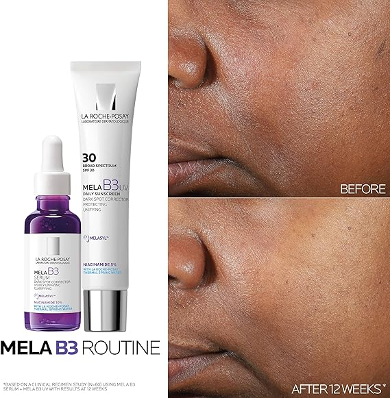 سيروم لاروش بوزيه نياسيناميد 10 (30ml) -La Roche-Posay Niacinamide 10 Serum